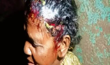 दुधावा क्षेत्र में आदमखोर तेंदुए का आतंक, 5 दिनों में 3 लोगों पर हमला, ग्रामीणों में दहशत
