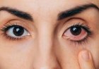 मानसून में तेजी से बढ़ रहा आई फ्लू (Eye Flu) का खतरा: जानें कंजंक्टिवाइटिस के लक्षण और बचाव के आसान उपाय